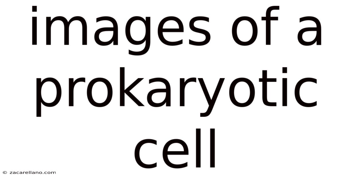 Images Of A Prokaryotic Cell