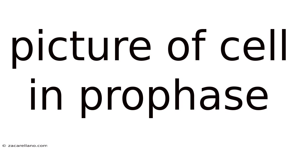 Picture Of Cell In Prophase